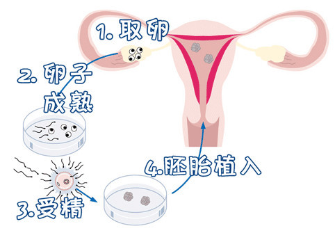 关于拉拉试管三代代孕机构